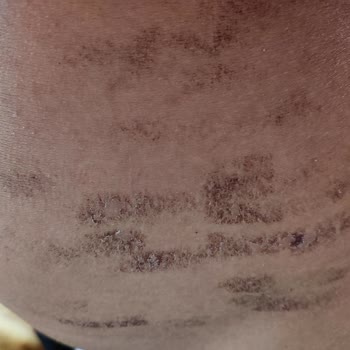 Derma Güzellik Müşteriyi Baştan Salma