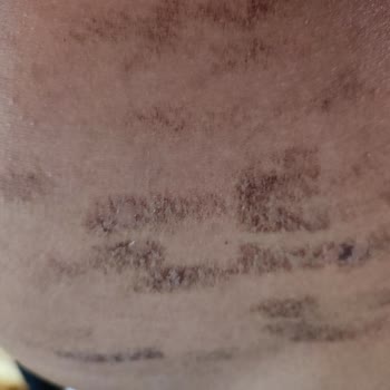 Derma Güzellik Müşteriyi Baştan Salma