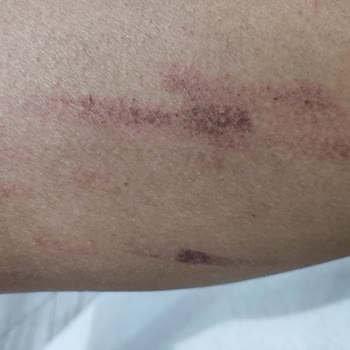 Derma Güzellik Müşteriyi Baştan Salma