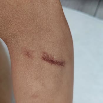 Derma Güzellik Müşteriyi Baştan Salma