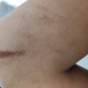 Derma Güzellik Müşteriyi Baştan Salma