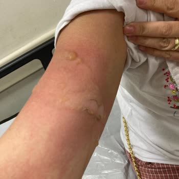 Hometech Patlayan Elektrikli Su Torbası