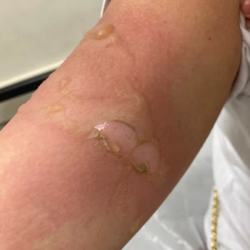 Hometech Patlayan Elektrikli Su Torbası