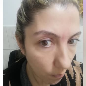 Vanity Estetik Başarısız Ameliyat