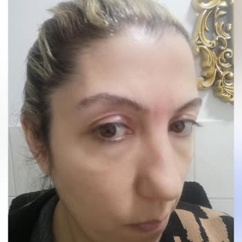 Vanity Estetik Başarısız Ameliyat