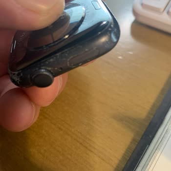 Kolunuza Taktığınız İçin Oksitlenen Apple Watch