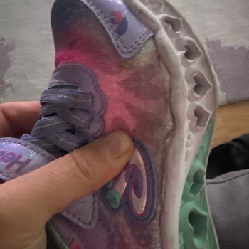 Skechers Ayakkabı Açılma Ve Soyulma