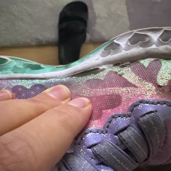 Skechers Ayakkabı Açılma Ve Soyulma