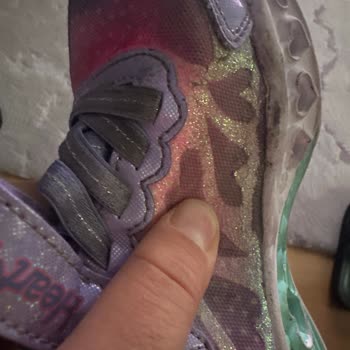 Skechers Ayakkabı Açılma Ve Soyulma