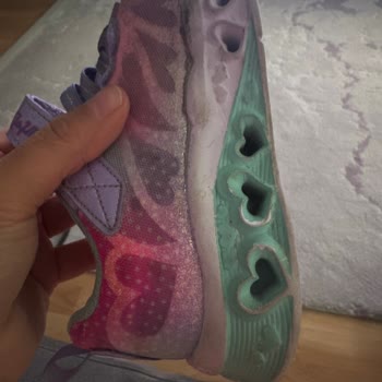 Skechers Ayakkabı Açılma Ve Soyulma