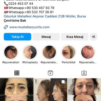 Eki aç