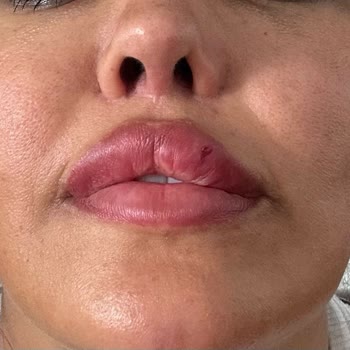 Op. Dr. Mustafa Özyurtlu İçin Öncelik Hastası Değil, Para