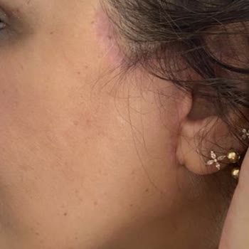 Op. Dr. Mustafa Özyurtlu İçin Öncelik Hastası Değil, Para