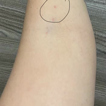 Bilkent Şehir Hastanesi Hemşire Şikayeti-12 Ekim 2023