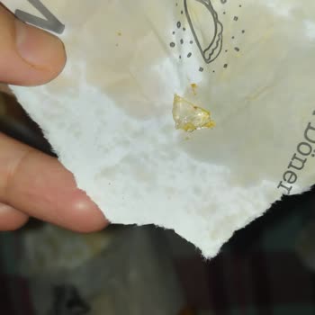 Maydonoz Döner Eskişehir Şubesi Dürümden Cam Çıktı