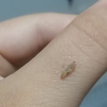 Gürbüzler Kuruyemiş G******** Orcik Şekeri Den Sinek Çıktı