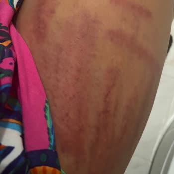 Neslim Güngen Güzellik Pendik Şubesinde Yaşadığım Sorunlar