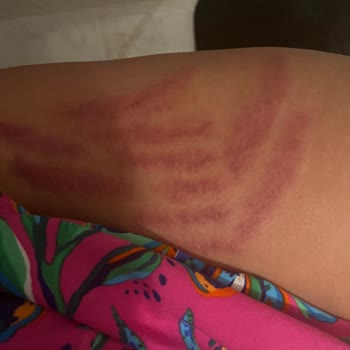 Neslim Güngen Güzellik Pendik Şubesinde Yaşadığım Sorunlar