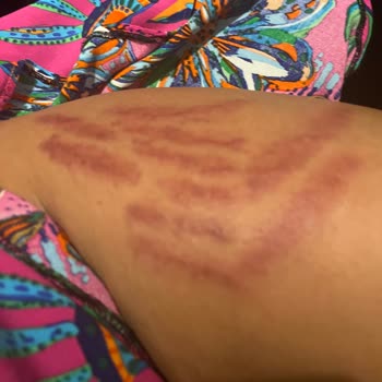 Neslim Güngen Güzellik Pendik Şubesinde Yaşadığım Sorunlar