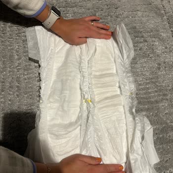 Yenilenmiş Molfix Pure Soft Eskisine Göre Kalitesiz Ve Sızdırıyor