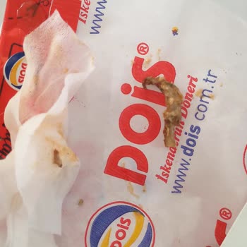 Dois Döner Yabancı Cisim Tavuk Tırnağı Çıktı