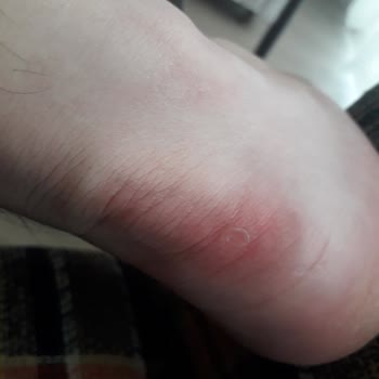 Oxide Ayakkabı FLO Dan Aldığım Ayıplı Ayakkabı