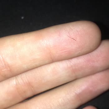 Mc Donald's Kıl Çıktı