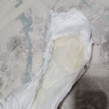 Sleepy Külot Bez 5 Numara Problemi