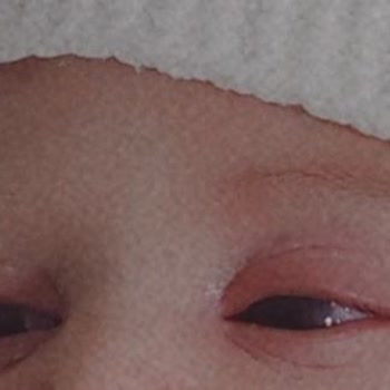 Bebe Land Şampuan Yakıcı