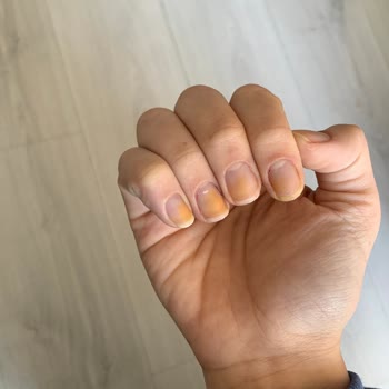 Pastel Kozmetik Oje Tırnağımda Turuncu Leke Bıraktı