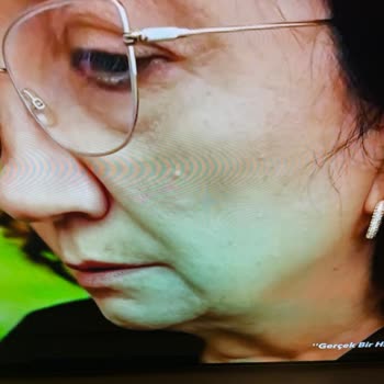 LG Oled TV Ekran Bozulması