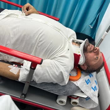 Renault Servisinde Yaşadığım Kaza