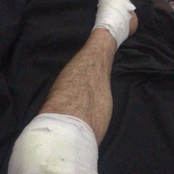 Renault Servisinde Yaşadığım Kaza