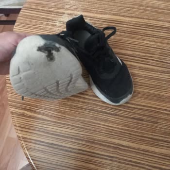A101 Adidas Ayakkabı Garanti Sorunu