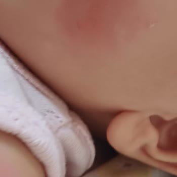 Mustela Stelatopia Kızarıklık Sorunu