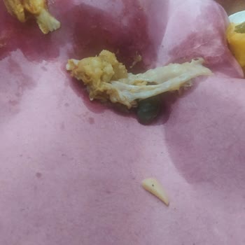 Efes Döner & İskender Sağlık Açısından Çok Kötü