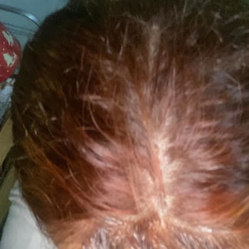 Sea Color Saç Boyası Şikayet