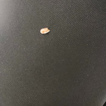 Migros Çikolatasının İçinden Plastik Parça Çıktı