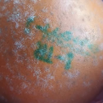 Onur Hipermarketleri Marketten Alınan Gezen Tavuk Yumurtası Küflü Çıktı