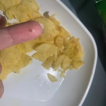 Lays Yüzünden Dişim Kırıldı