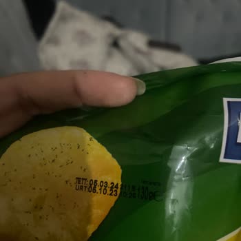Lays Yüzünden Dişim Kırıldı