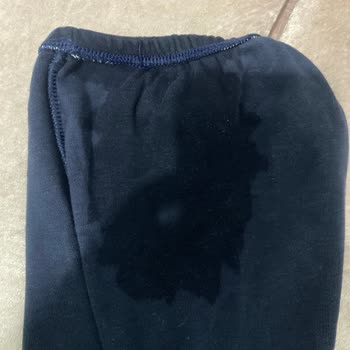 Molfix Bezlerin Taşırması Ve Mağduriyeti