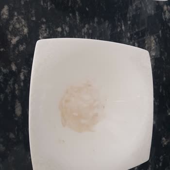 Karaca Züccaciye 62 Parça Yemek Takımında Solma Ve Yemek Lekesi Sorunu