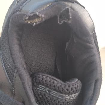 Skechers Ayakkabımın Yırtılması 8 Ay Sürede.