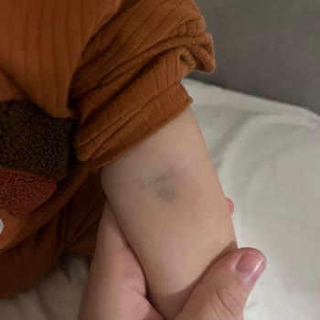 Mehmet Akif Ersoy Devlet Hastanesi Devlet Hastanesinde Sünnet İşleminde Yaşanan Sorunlar