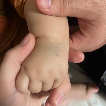 Mehmet Akif Ersoy Devlet Hastanesi Devlet Hastanesinde Sünnet İşleminde Yaşanan Sorunlar