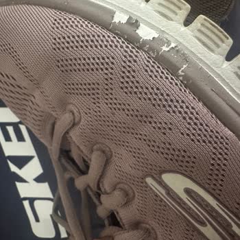 Skechers Ayakkabısının Boyası Dökülüyor Ve Asla Bunu Umursamıyorlar!