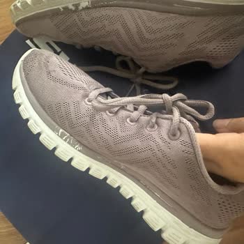 Skechers Ayakkabısının Boyası Dökülüyor Ve Asla Bunu Umursamıyorlar!
