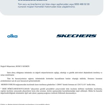 Skechers Ayakkabısının Boyası Dökülüyor Ve Asla Bunu Umursamıyorlar!