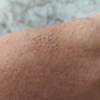 Trendyol İade Kabul Etmemesi Ve Satılan Ürünün Sağlığa Zararlı Oluşu